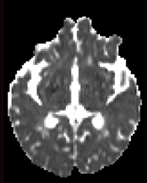 dMRI Param Mapping Original 1 Diagram