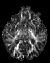 dMRI Param Mapping Original 2 Diagram