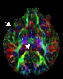 dMRI Param Mapping Original 3 Diagram