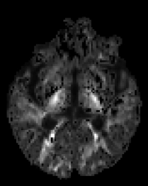 dMRI Param Mapping Original 4 Diagram