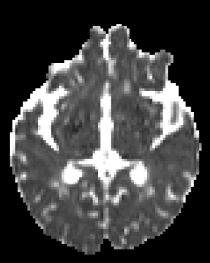 dMRI Param Mapping RMT 1 Diagram