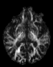 dMRI Param Mapping RMT 2 Diagram