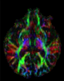 dMRI Param Mapping RMT 3 Diagram