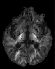 dMRI Param Mapping RMT 4 Diagram