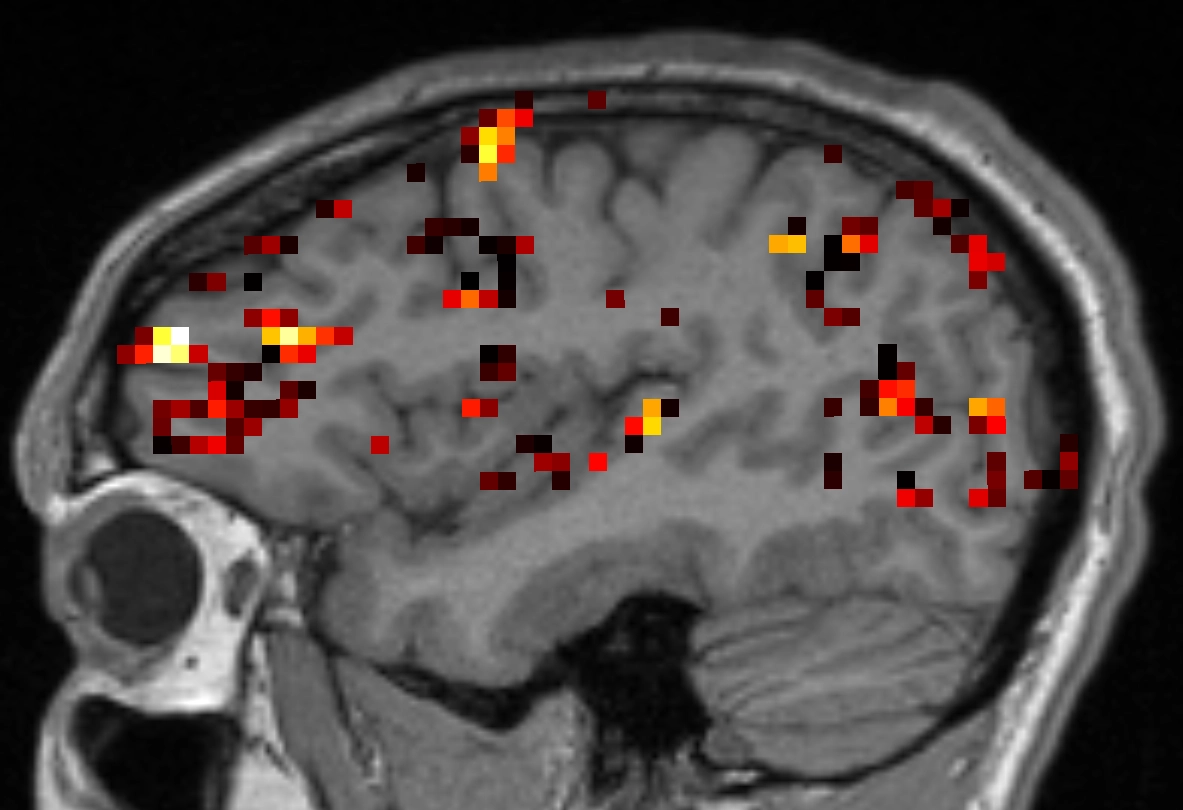 Neural Activity Original Diagram