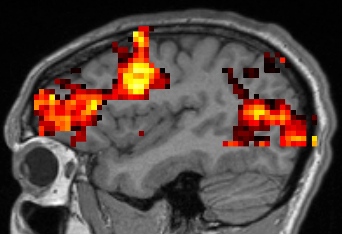 Neural Activity RMT Diagram