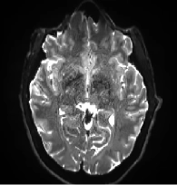 Methods Applied - Neural Diagram