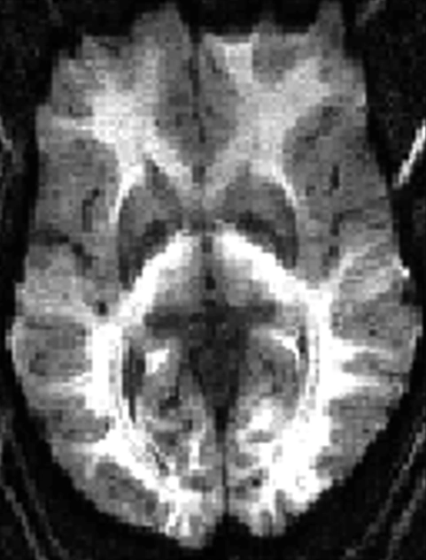 MRI Contrast RMT 8 Diagram