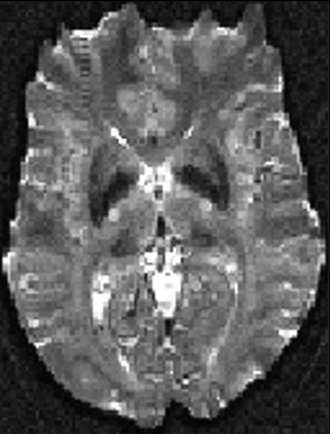 MRI Contrast Original 2 Diagram