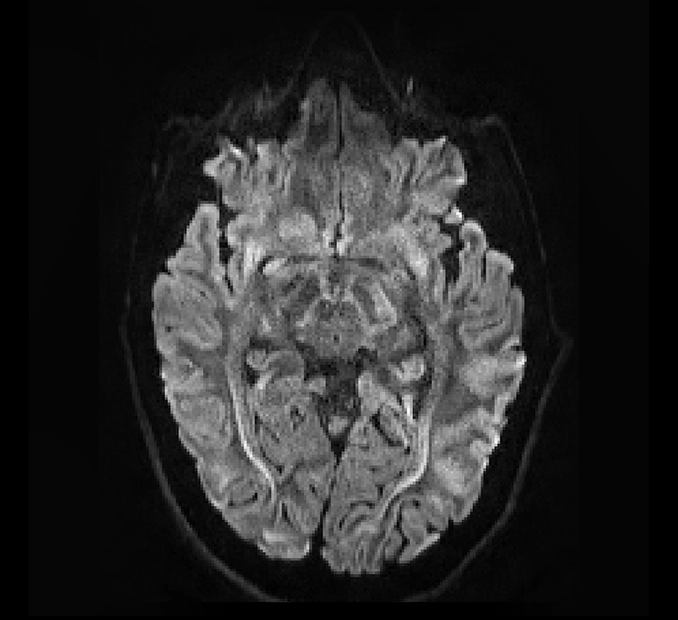 MRI Quality Set 1 MICSI