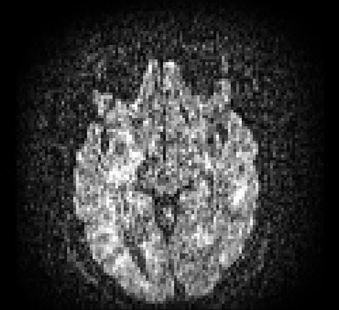 MRI Quality Set 2 Original